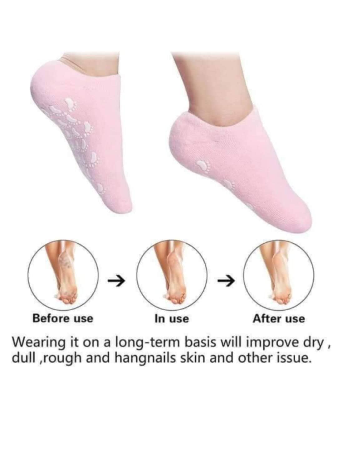 جوارب جل سيليكون مرطبة للقدمين مع سطح مضاد للانزلاق - Chaussettes Gel Silicone Hydratantes Pieds Antidérapantes