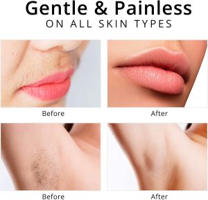 ماكينة إزالة الشعر الكهربائية 4 في 1 للوجه والجسم | Quickdz Shop - Rasoir Épilateur Électrique 4en1 Visage & Corps | Quickdz Shop