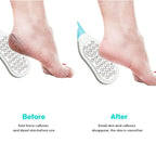 مجموعة 5 قطع مبرد قدم احترافي SUGIFT - Kit Pédicure Professionnel 5 Pièces SUGIFT