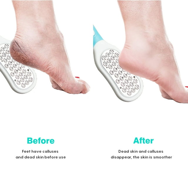 مجموعة 5 قطع مبرد قدم احترافي SUGIFT - Kit Pédicure Professionnel 5 Pièces SUGIFT