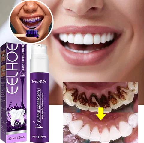 معجون أسنان بنفسجي لتبييض الأسنان ومصحح اللون 50 مل - يزيل البقع وينعش النفس - Dentifrice Blanchissant Violet Correcteur de Couleur 50ml - Élimine Taches & Rafraîchit l'Haleine