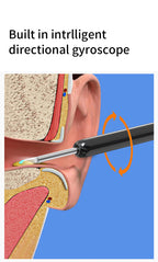 منظار الأذن اللاسلكي الذكي NE3 مع كاميرا وضوء LED - Kit de nettoyage d'oreilles intelligent sans fil NE3 avec caméra et LED