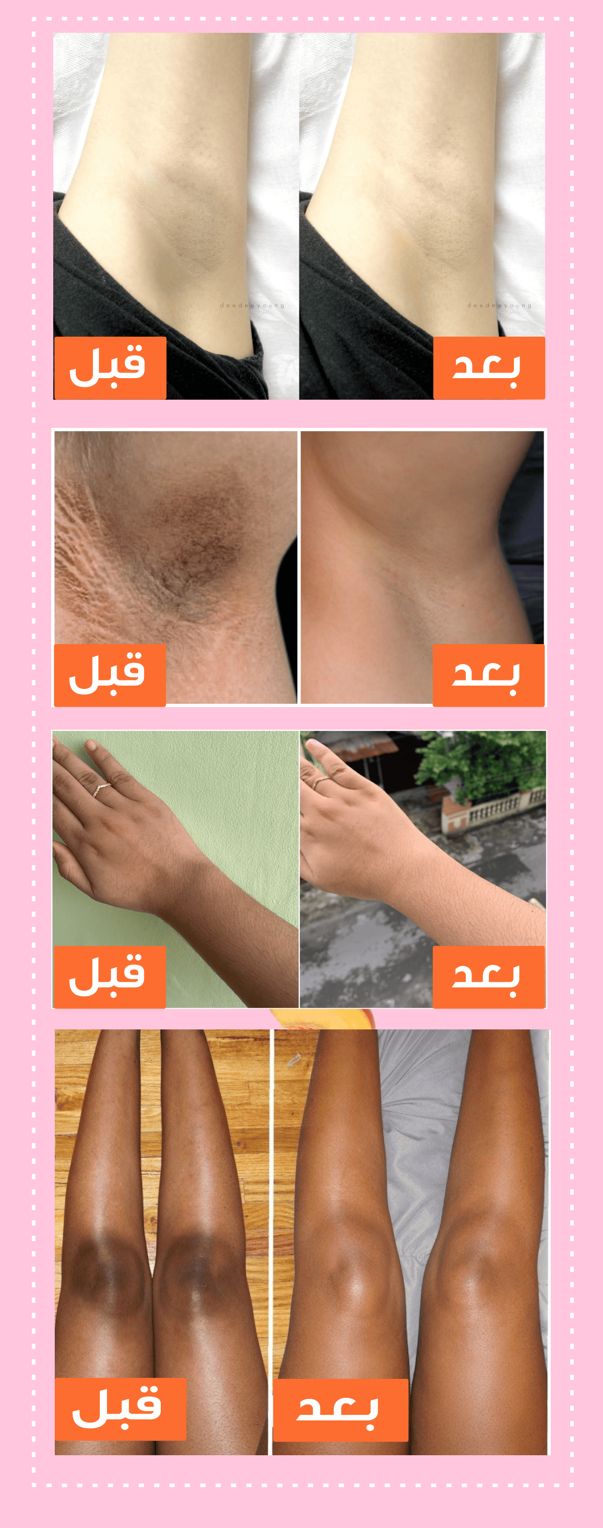 BIOAQUA™ لتفتيح البشرة الفوري - BIOAQUA™ Éclaircissant Instantané pour la Peau