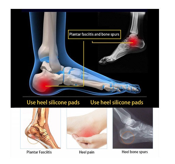 وسادات كعب سيليكون Quickdz Shop | تخفيف آلام الكعب والتهاب اللفافة الأخمصية - Talonnettes Silicone Souples Quickdz Shop | Soulagement Douleur Talon & Fasciite Plantaire